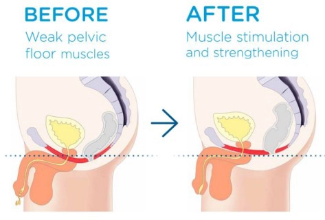 Chronic Pain Round Rock TX Before And After Man